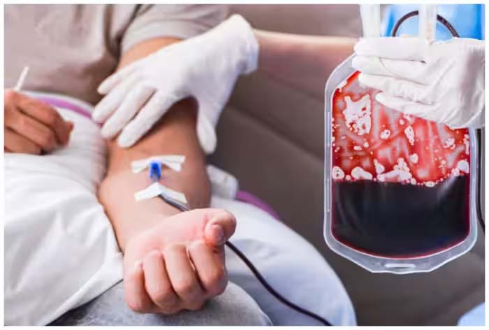 Read more about the article मरीज को गलती से दूसरा ब्लड ग्रुप चढ़ा दिया तो क्या होगा