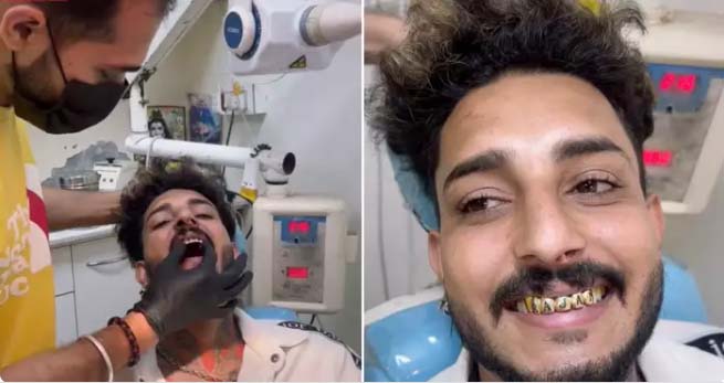 Read more about the article सोने के दांत लगवा रक व्यूज मिल चुके