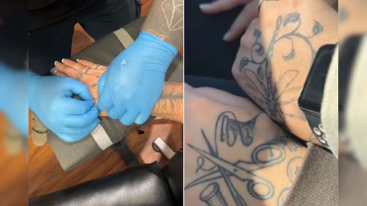 Read more about the article बॉयफ्रेंड-गर्लफ्रेंड ने भी अपने शौक और प्यार को मिलाते हुए शरीर में चुंबक डलवा