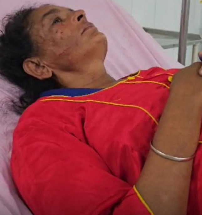 Read more about the article ਕਲਯੁਗੀ ਨੂੰਹ -ਪੁੱਤਰ ਨੇ ਕਰੋੜਾਂ ਰੁਪਏ ਦੀ ਜਾਇਦਾਦ ਹੜੱਪਣ ਲਈ ਬਜ਼ੁਰਗ ਮਾਂ ਨਾਲ ਕੀਤੀ ਕੁੱਟਮਾਰ