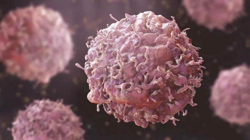 You are currently viewing ਪੰਜਾਬੀਆਂ ਦਾ ਜੀਵਨ ਕੈਂਸਰ ਦੀ ਜਕੜ ‘ਚ; ਰੋਜ਼ਾਨਾ 68 ਮੌਤਾਂ ਦਰਜ